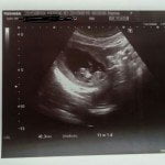 IVF Baby