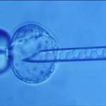 Mikroinjektion in Zypern ( Befruchtungsprozess | ICSI )