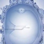 Microenjeksiyon (İntrastoplazmik Sperm Enjeksiyonu - ICSI)