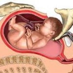 Normale Geburt und Kaiserschnitt