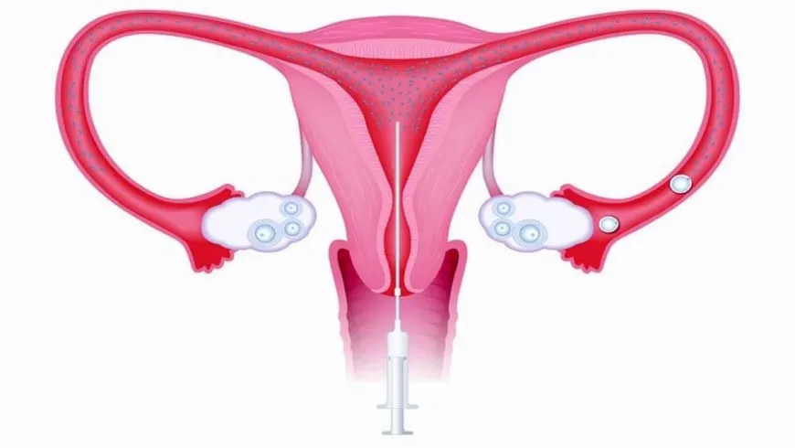 Endometrium Scratching