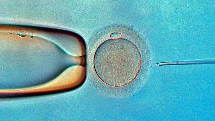 IVOX IVF Nord Zypern Klinik 26 Microinjection
